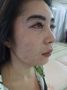 Empat Pelaku Pengeroyokan Janda Masih Berkeliaran