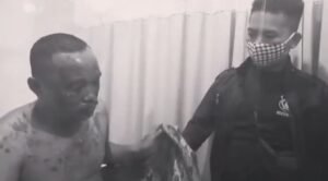 Bapak Disiram Air Keras, Anak Ditusuk Oleh Orang Tidak Dikenal