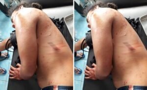 Gara-Gara Eceng Gondok, Masarga Ditusuk di Pinggang