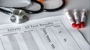 Tambah 94 Kasus, Pasien Covid 19 Sumsel Menjadi 8.090 Orang