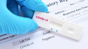 Hasil Rapid Test 15 Orang Kontak Erat Pasien COVID-19 asal Permis Non Reaktif