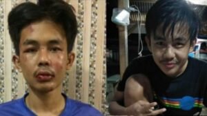 Dalam Keadaan Sehat, Penusuk Syekh Ali Jaber Dikenai Pasal Berlapis