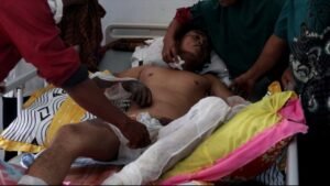 Disengat Listrik Bertegangan Tinggi, Helmi Dilarikan ke RSUD Besemah