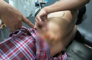 Kades Lubuk Larak, Pedamaran Ditikam OTD