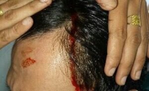 Guru Honorer Diduga Dianiaya Wali dan Siswanya