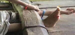 Tekan Angka Pemasungan, Dinkes Muratara Bakal Latih Keluarga Penyakit Jiwa