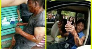 Truk Tangki Pengangkut BBM Terbakar