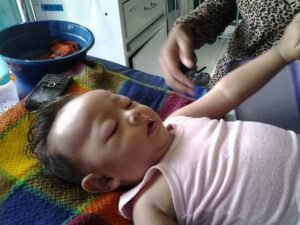 Salah Infus, Sekujur Tubuh Balita 11 Bulan ini Membengkak