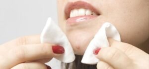 Ini Penyebab Jerawat Terus Muncul di Tempat yang Sama