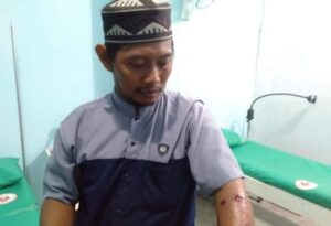 Warga Muara Kelingi Alami Dua Luka Tembak di Tangan